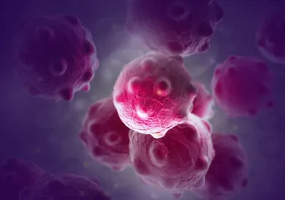 Render of cancer cells Render of cancer cells